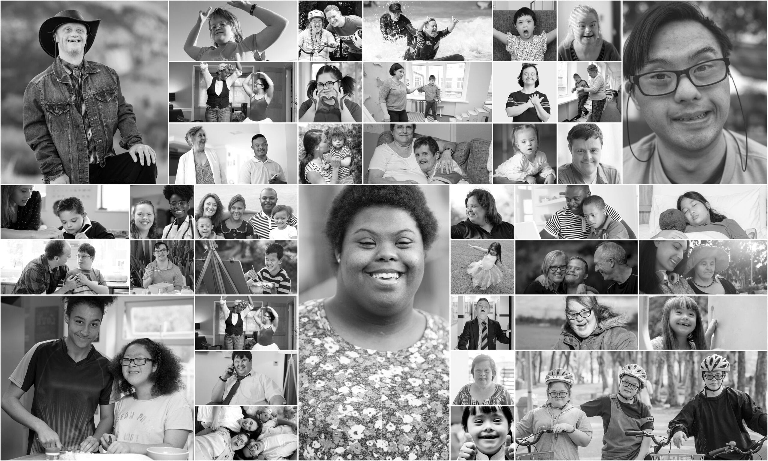 Understanding key differences among Alzheimer’s clinical trials in Down syndrome
